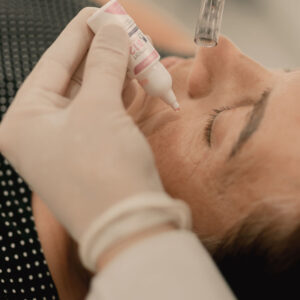 Taller Dermapen